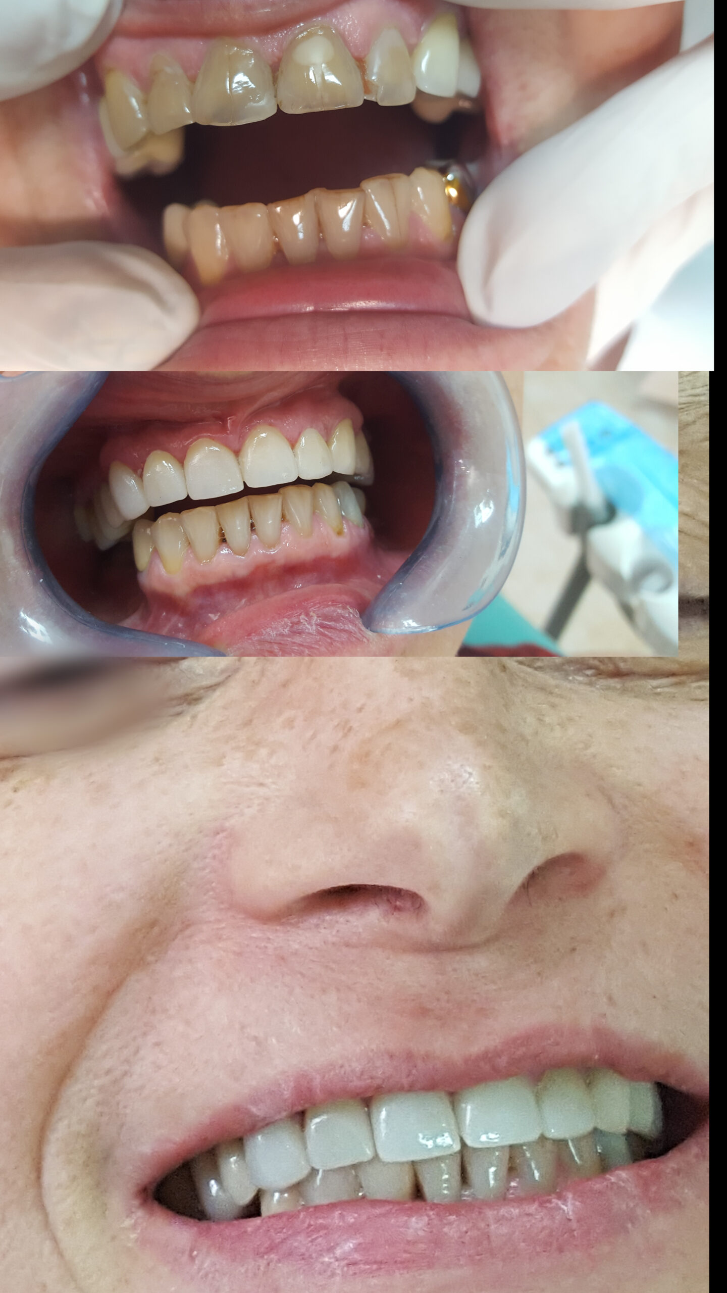 marina guzova after(1)_00000