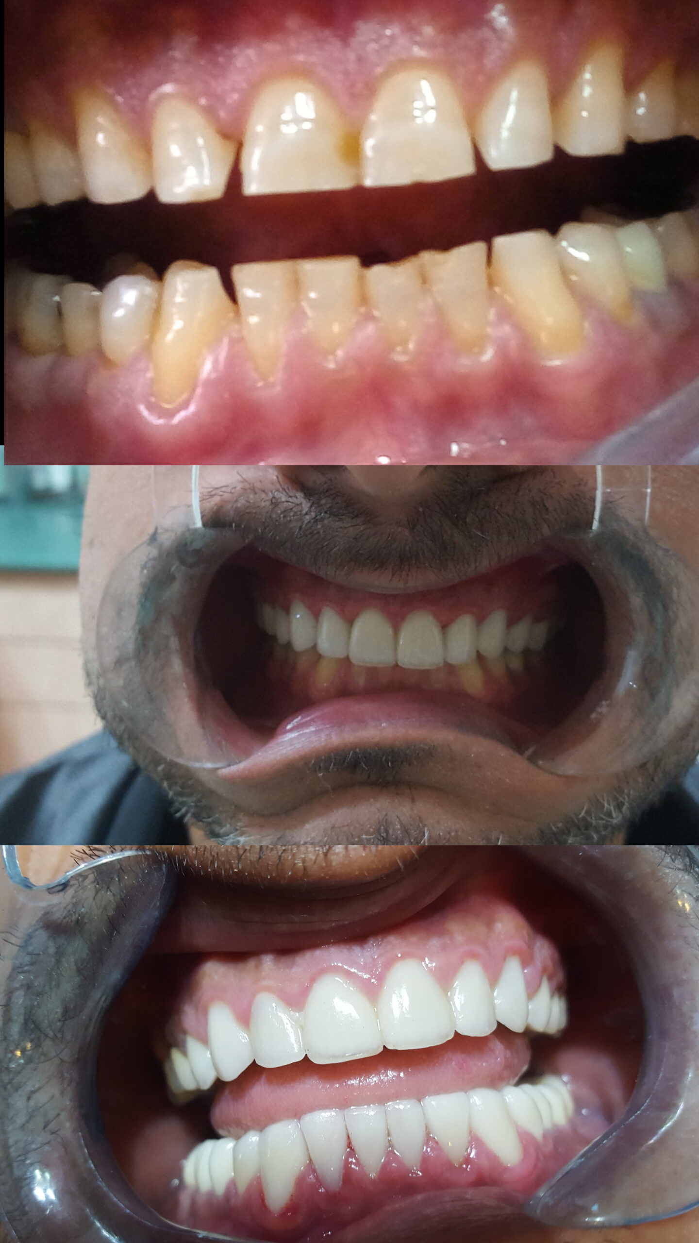 nidal milaui after(1)_00000